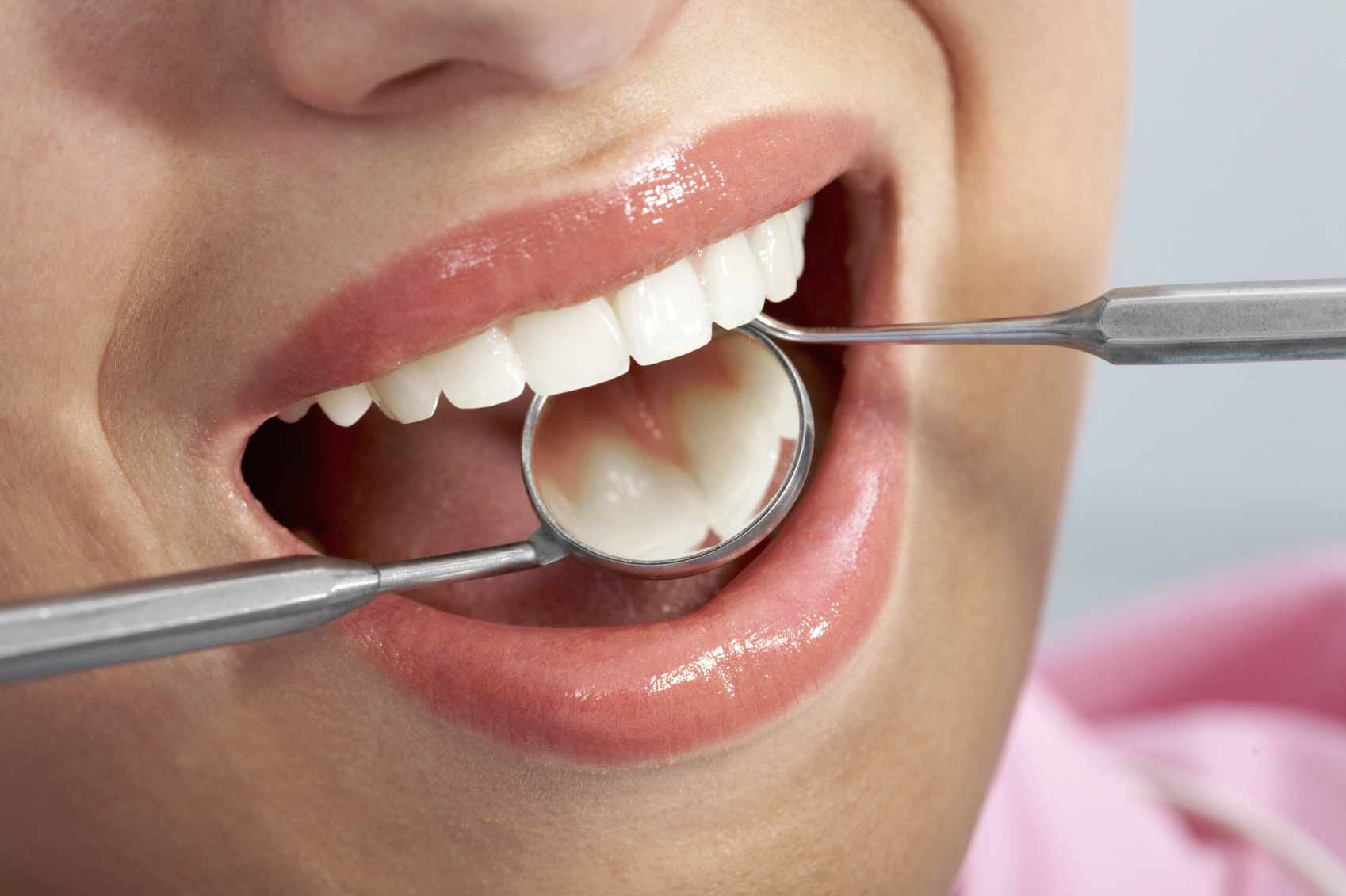 Осмотр зубов перед гигиеной полости рта