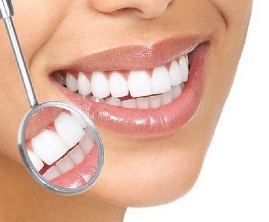 Эстетическая реставрация зубов композитами Enamel