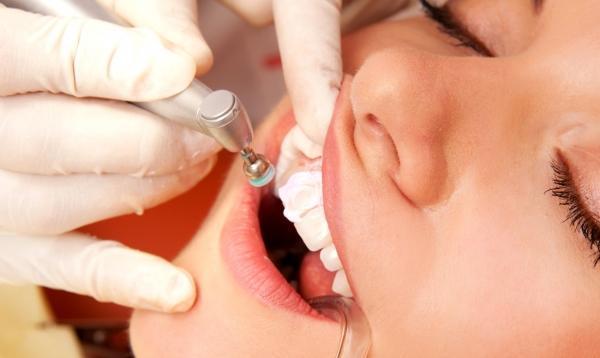 Комплекс процедур профессиональной гигиены рта